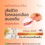 โอลิซ่า คิวเท็น