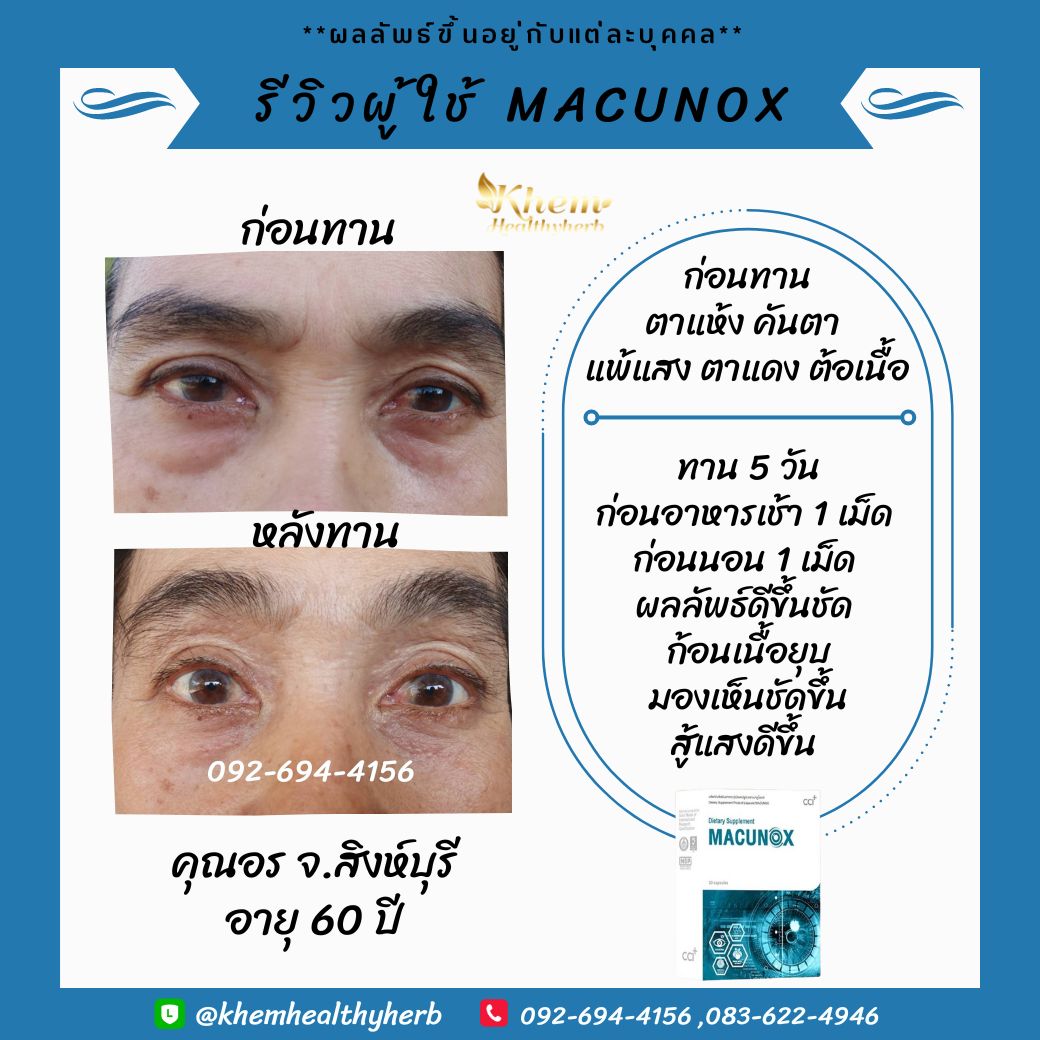 มาคูน็อกซ์ macunox